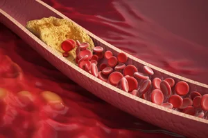 cholesterol closeup2 Cholesterol cross-section.