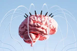 brain-wiring A futuristic, surreal image of a brain suspended in mid-air, intricately connected to multiple wires.