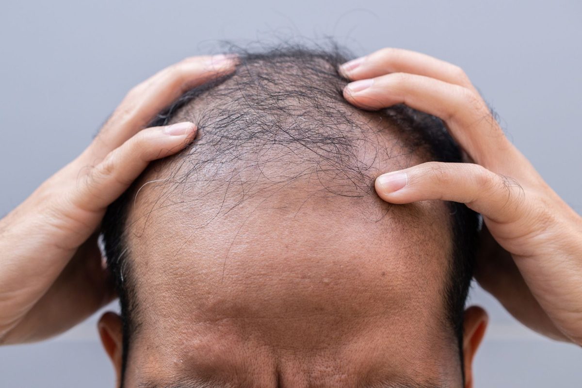 We're finally learning why hair loss happens – and how to reverse it