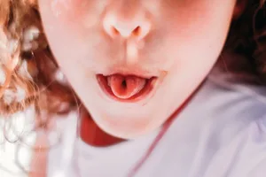 tongue-rolling-gene-myth Close up photo of a child sticking their rolled up tongue out of their mouth