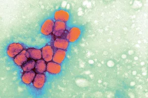smallpox-samples Smallpox virus
