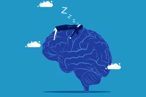 woman sleeping on brain woman sleeping on brain.