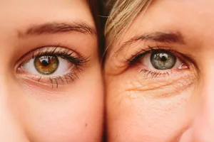 anti-ageing-eyes (1) Young and old eyes