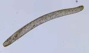 Spirostomum