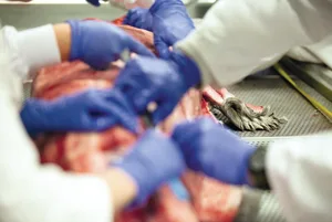 seal biopsy